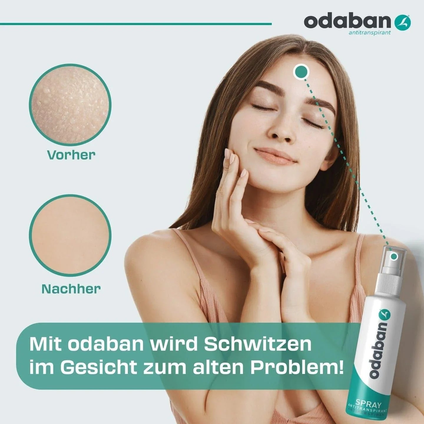 HyperSchwitzen Deo-Set – Aluminiumfrei, Gegen Reizungen, 2x50 Ml, Für Starkes Schwitzen